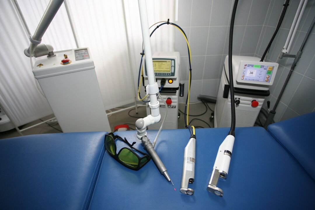 laser equipment for the removal of warts