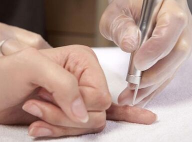 Conducting laser therapy